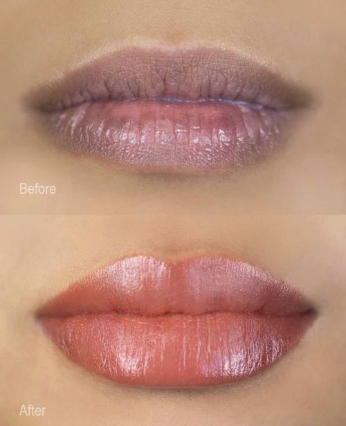 A before and after photo of a woman 's lips.