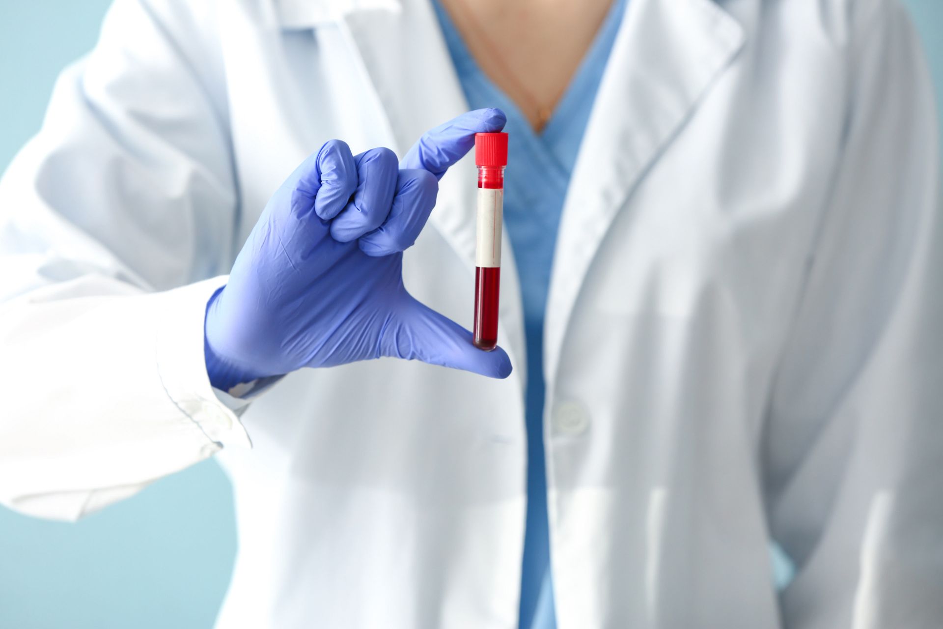 Gloved lab technician holding a red-capped blood sample tube in a white coat