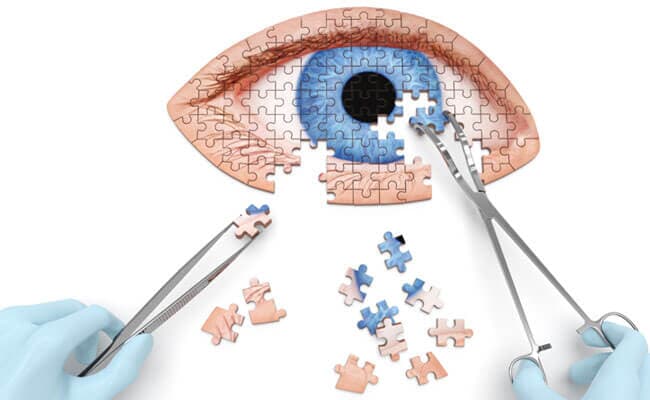 DR. JORGE A. MÍLLER URÍAS - CIRUGIA-DE-CATARATAS