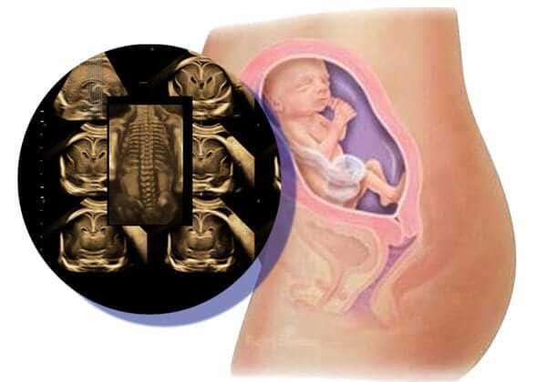 Medicina Fetal Avanzada – Neurosonografía 20 semanas