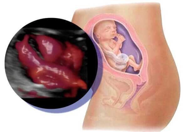 Medicina Fetal Avanzada – Ecocardiografía funcional
