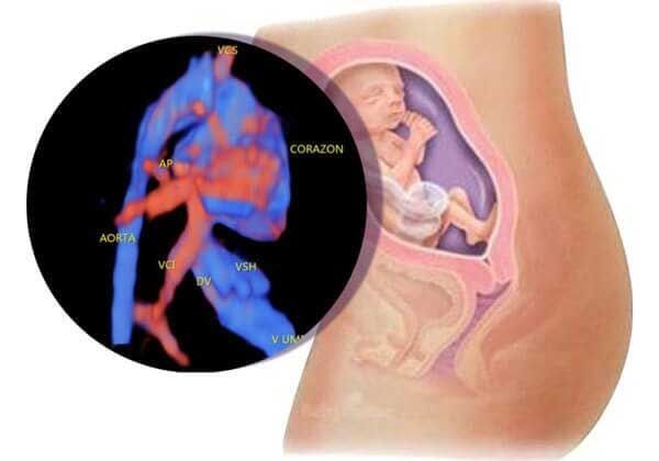 Medicina Fetal Avanzada – Ecocardiografía precoz de 14 a 16 semanas