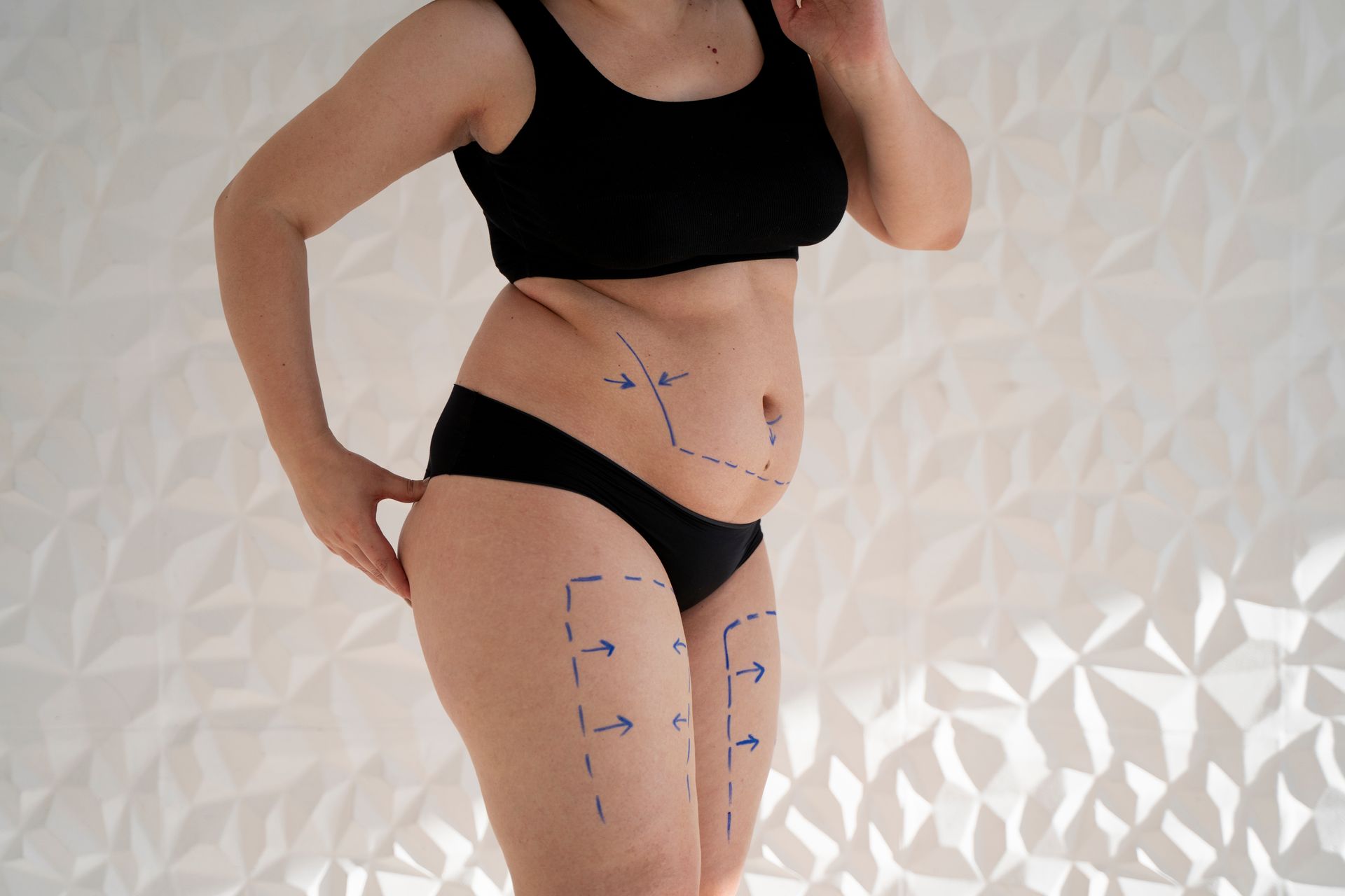A woman in black underwear has lines drawn on her stomach and legs.