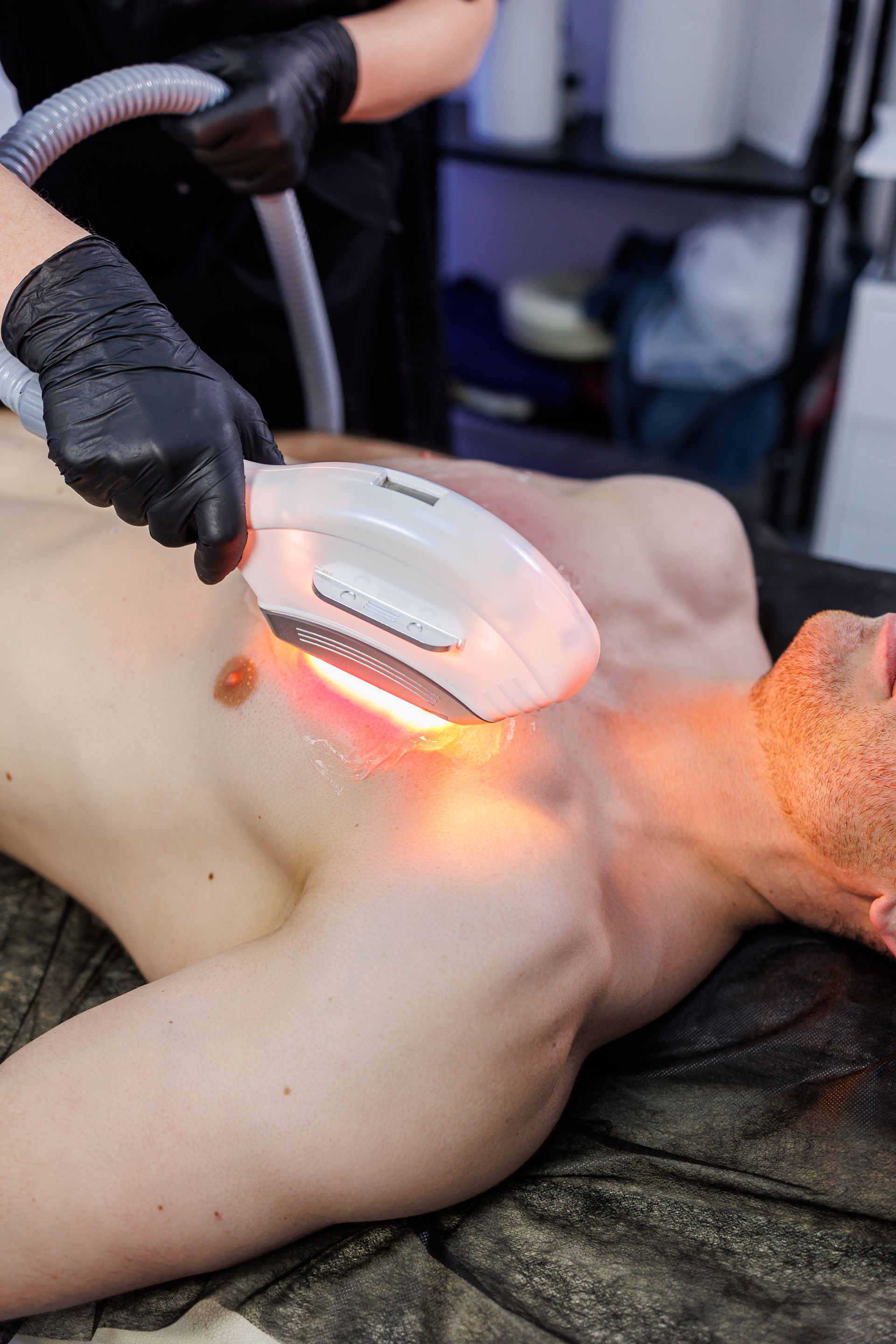 man getting laser hair removal on his chest