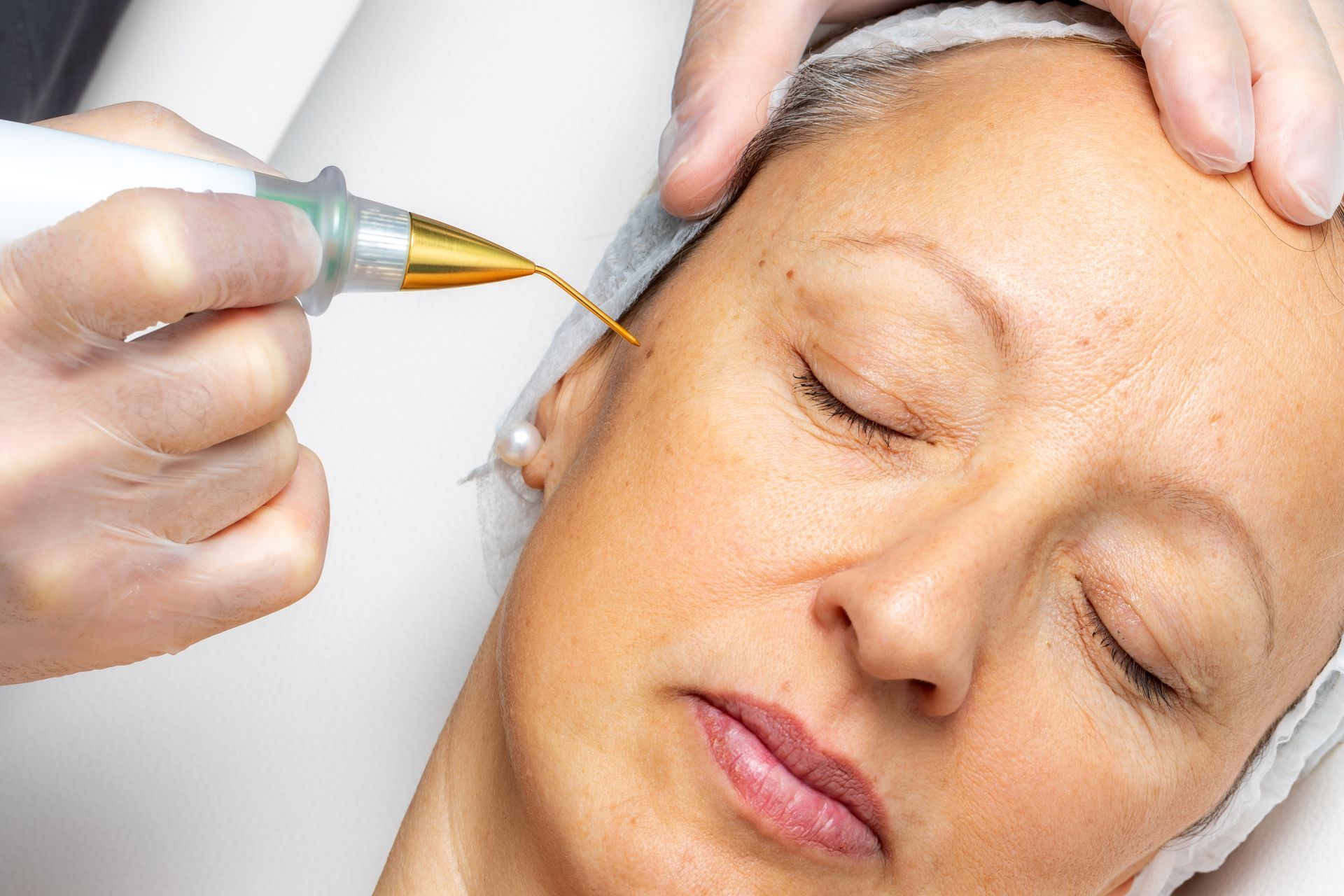 A woman is getting a laser treatment on her face.