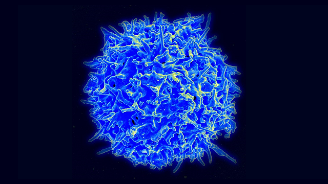 A human T cell WIKIMEDIA, NIAID, NIH