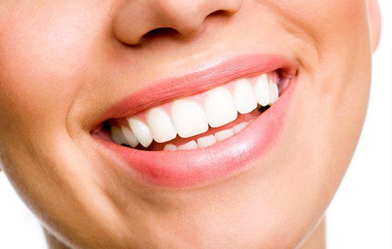 Lady's White Teeth — Colorado Springs, CO — Smile Heart Dental Hygiene