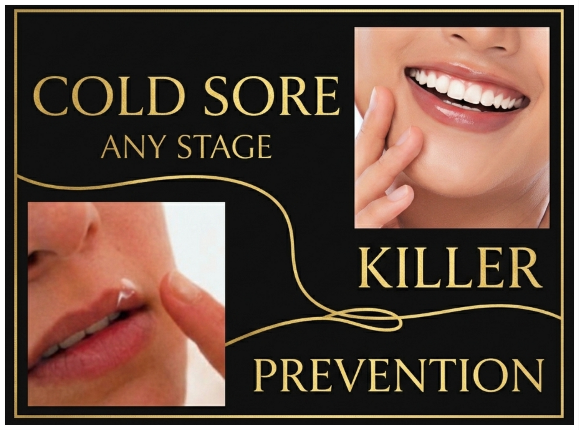 Cold sore prevention ad with mouth closeups and text “Cold Sore Any Stage Killer Prevention”