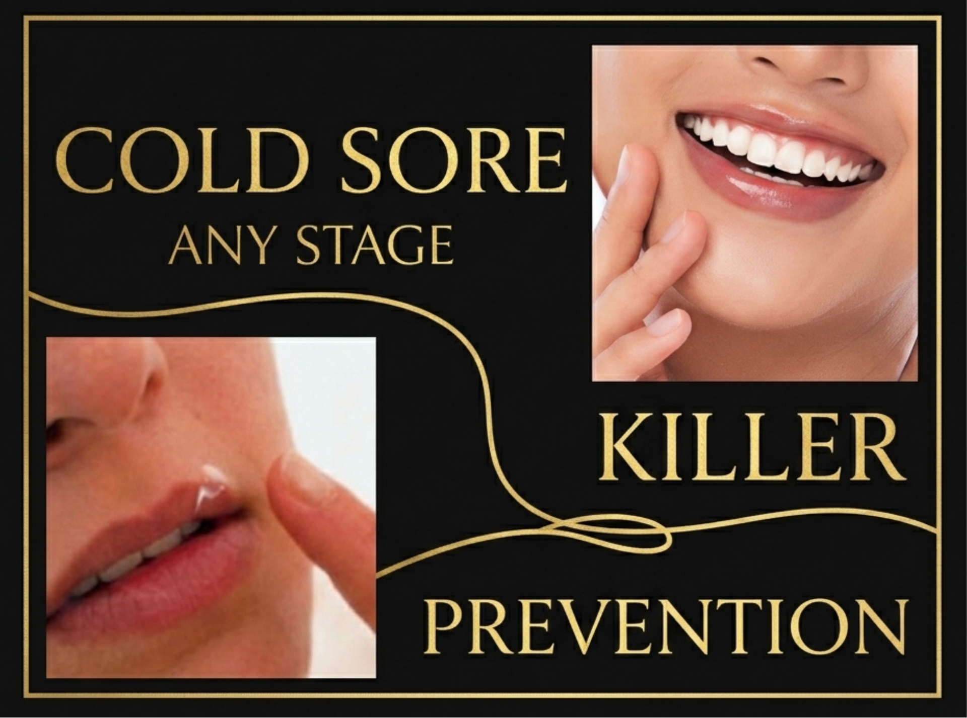 Cold sore prevention ad with close-ups of lips and a finger applying cream, gold text on black background