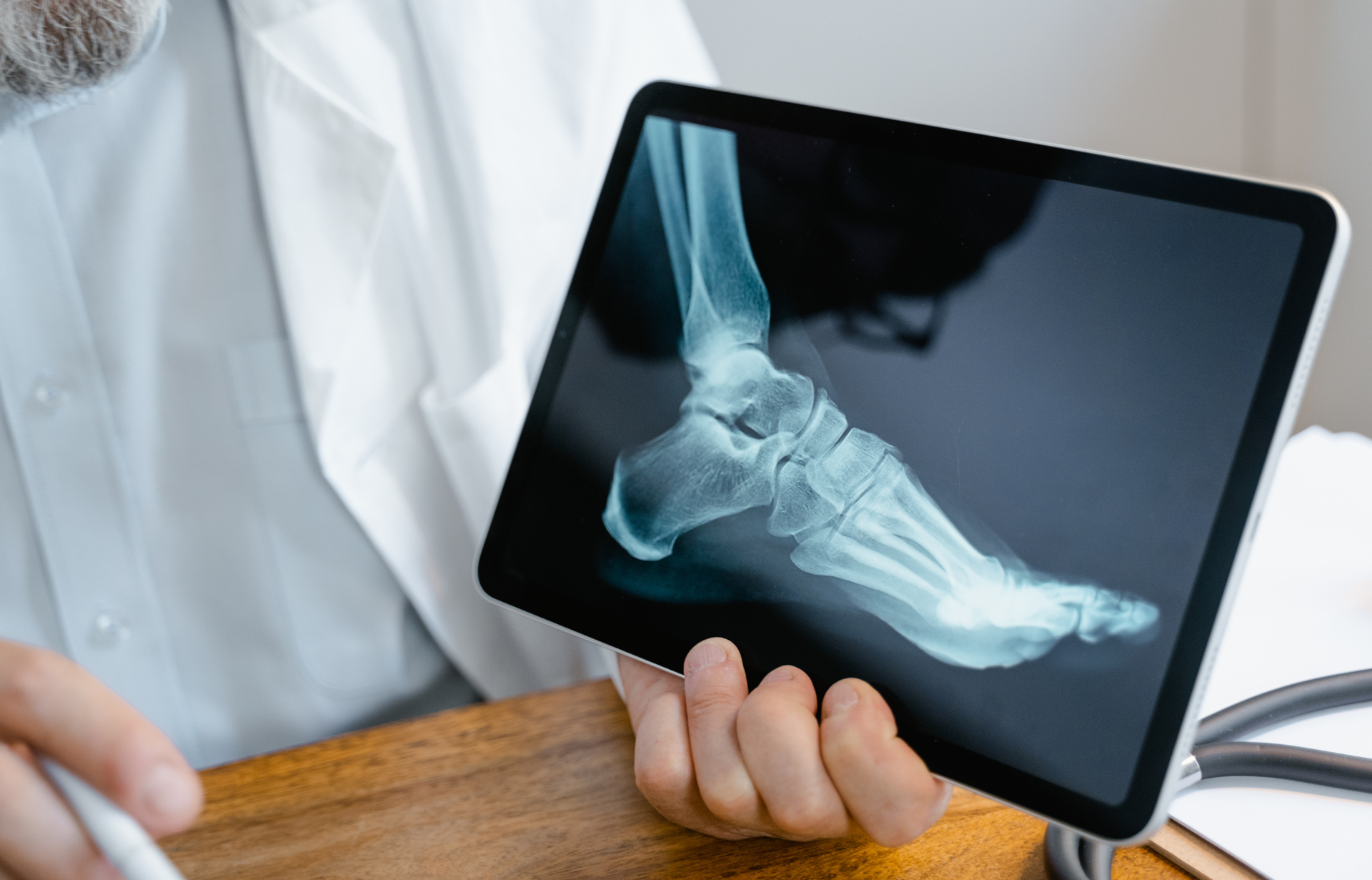 A doctor is holding a tablet with an x-ray of a foot on it.