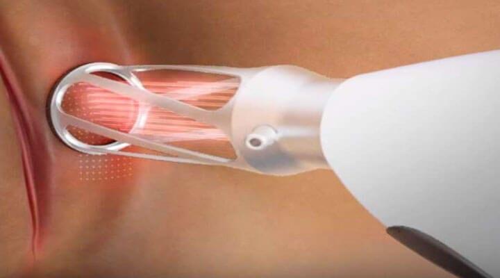 Centro de Ginecología Estética y Regenerativa