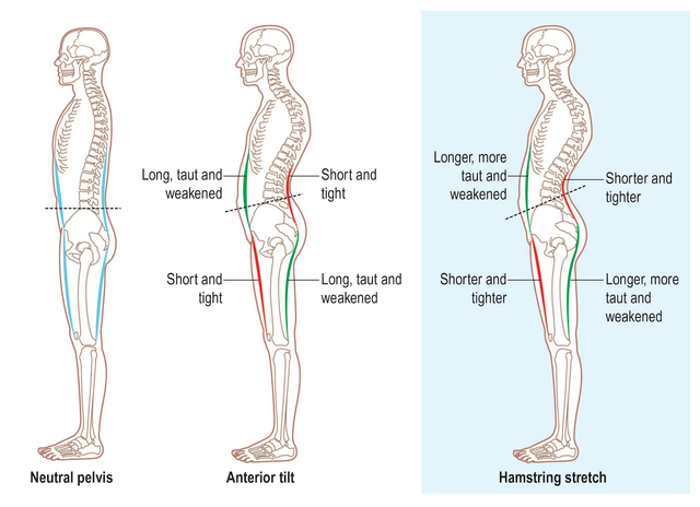 Hamstrings painfully tight sale