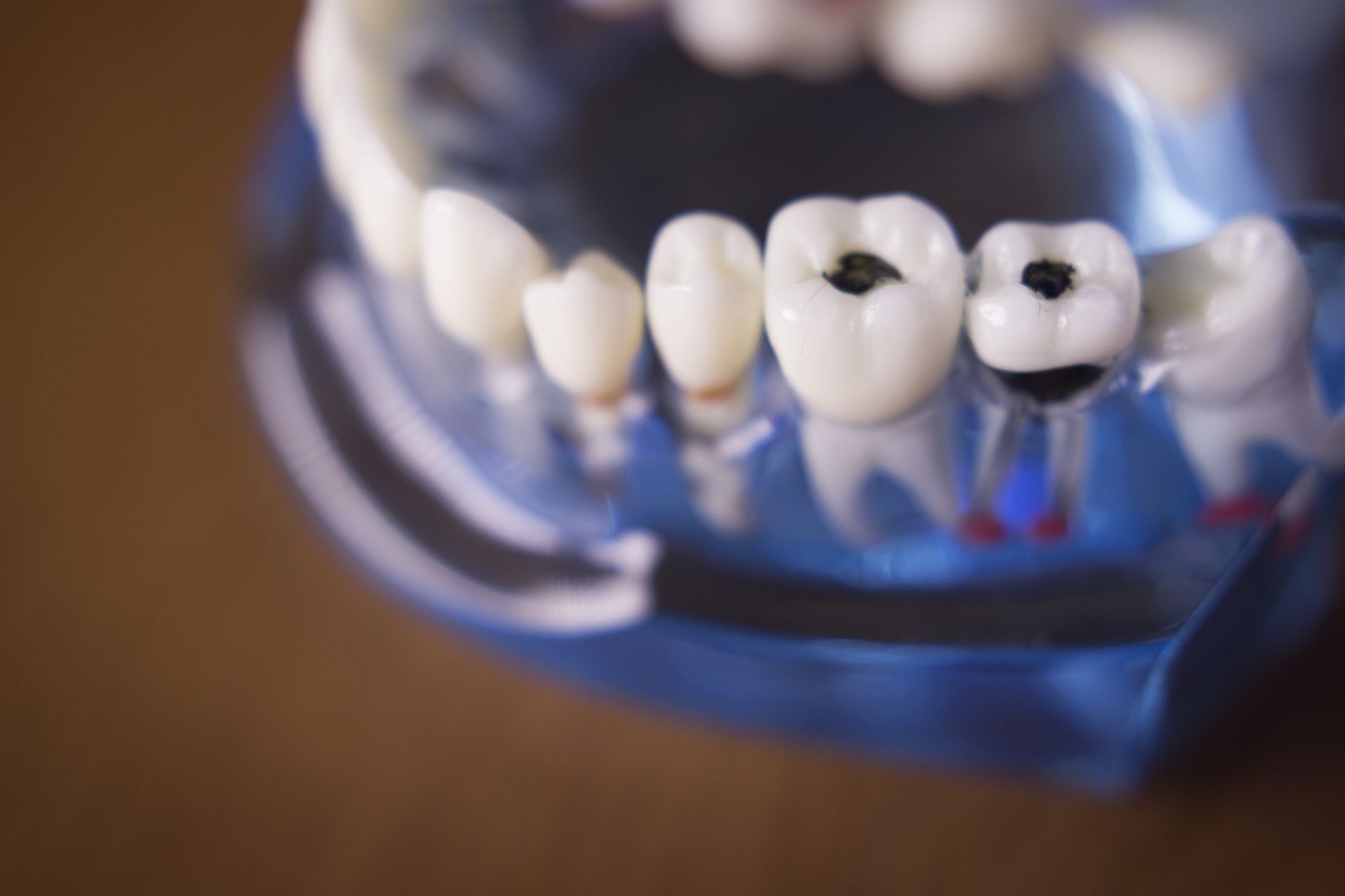 protesi fisse e mobili