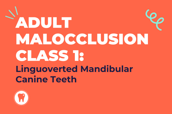 A poster for adult malocclusion class 1 : linguovected mandibular canine teeth