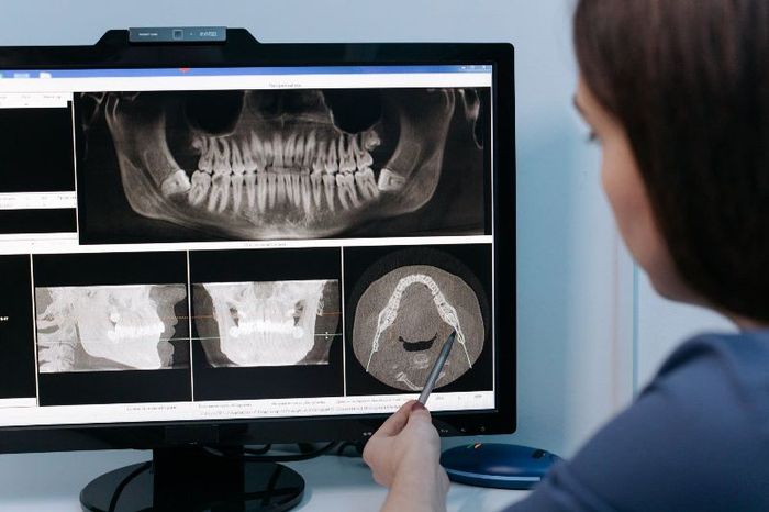 A woman is looking at an x-ray of a person 's teeth on a computer screen.