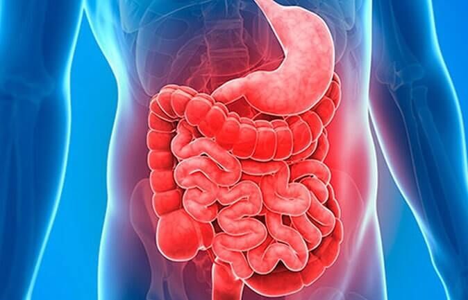 DR RIGOBERTO CASTRO ZÚÑIGA ESPECIALISTA EN ENDOSCOPIA DIGESTIVA - tratamiento para Diverticulitis