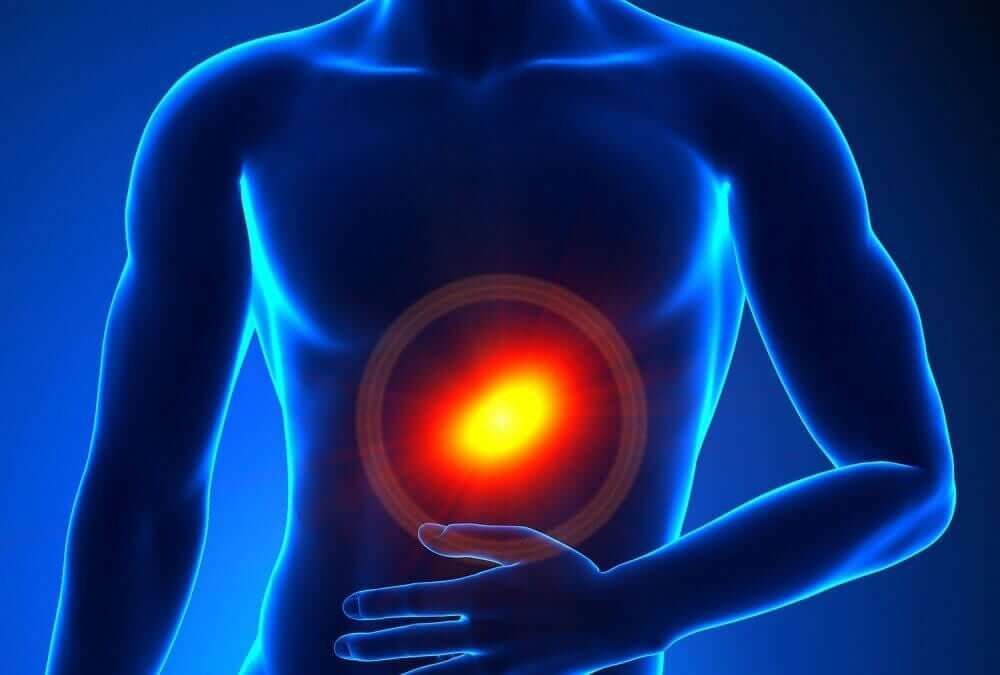 DR RIGOBERTO CASTRO ZÚÑIGA ESPECIALISTA EN ENDOSCOPIA DIGESTIVA - Absceso Pancreático