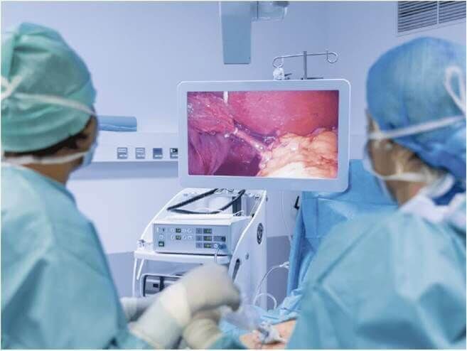 DR RIGOBERTO CASTRO ZÚÑIGA ESPECIALISTA EN ENDOSCOPIA DIGESTIVA - Tratamiento para Hemorroides