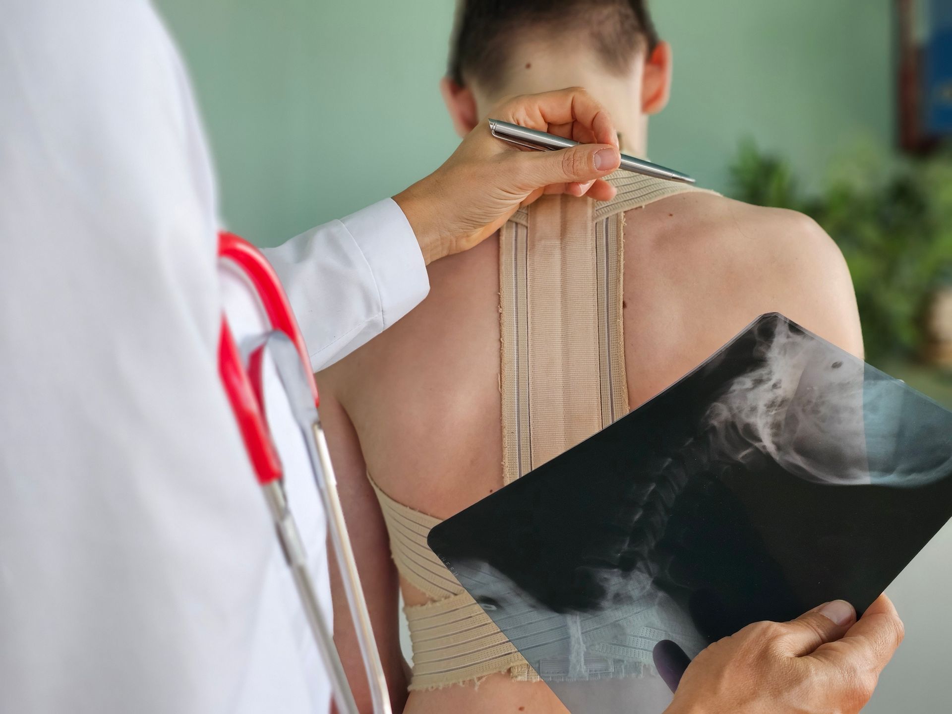 Pain management doctors examining patient's spine with X-ray and alignment tool.