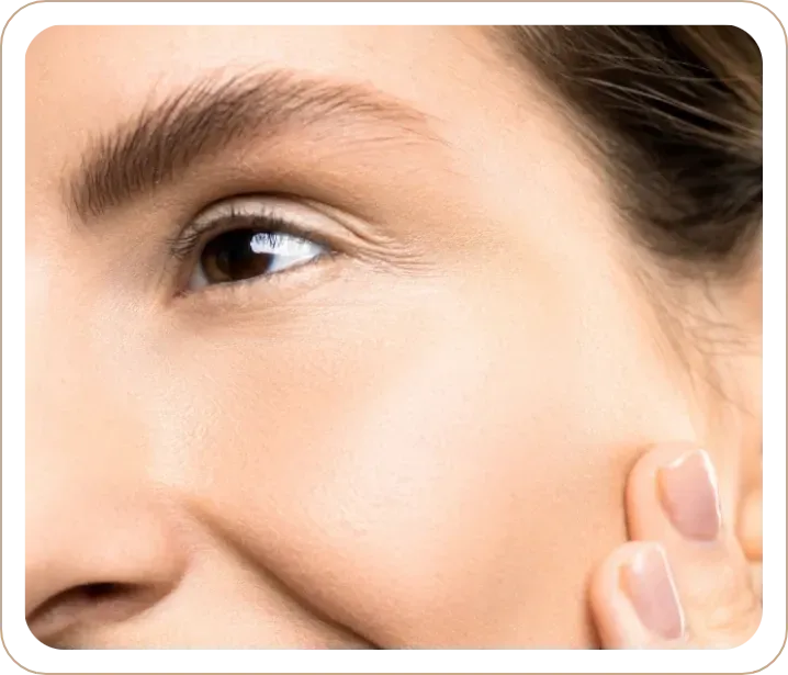 Radiofrequenz-Microneedling (Genius®)