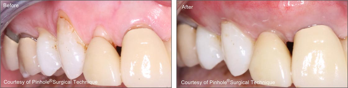 Teeth image 1 — East Hills Family Dentistry in Anaheim Hills, CA