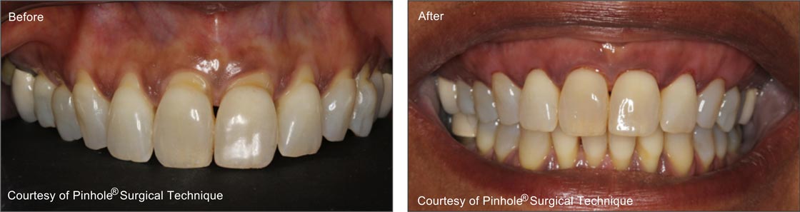 Teeth image 2 — East Hills Family Dentistry in Anaheim Hills, CA