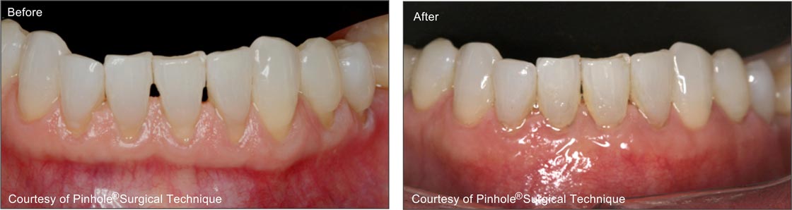 Teeth image 3 — East Hills Family Dentistry in Anaheim Hills, CA