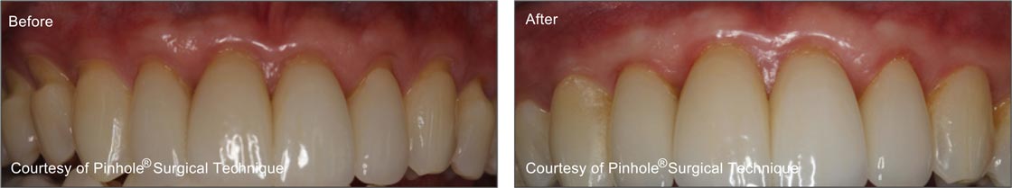 Teeth image 4 — East Hills Family Dentistry in Anaheim Hills, CA