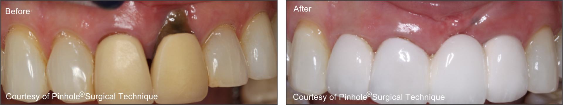 Teeth image 5 — East Hills Family Dentistry in Anaheim Hills, CA