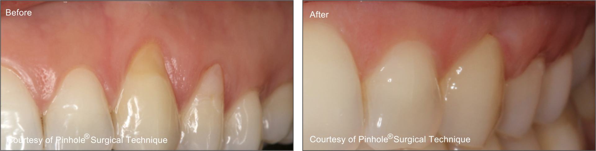 Teeth image 6 — East Hills Family Dentistry in Anaheim Hills, CA