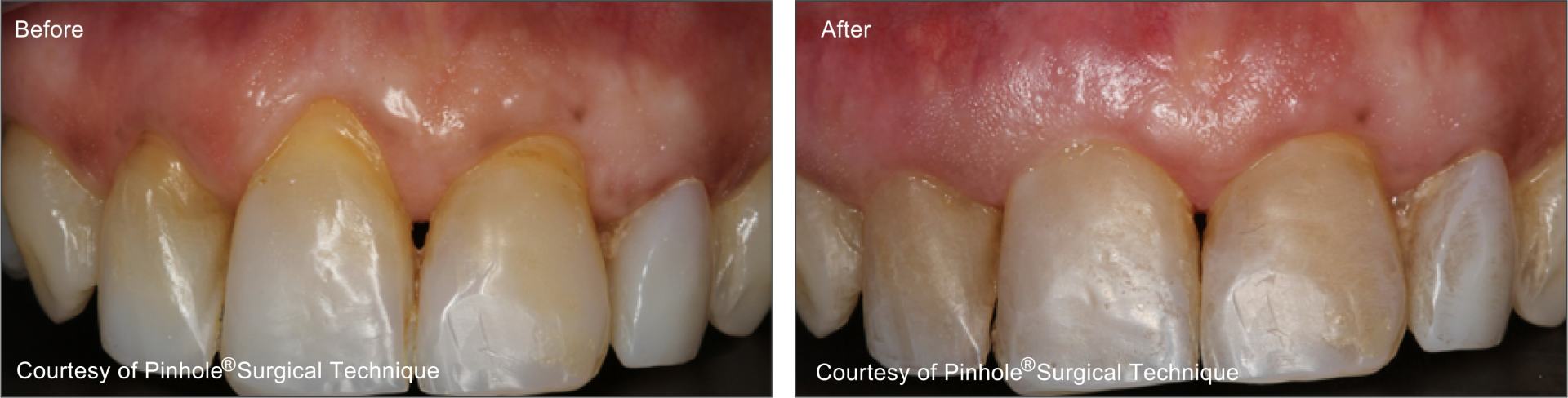 Teeth image 7 — East Hills Family Dentistry in Anaheim Hills, CA