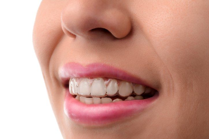 Traditional Braces and Invisalign®