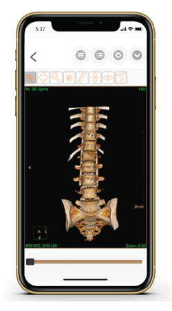 CareRadMD critical results communication on mobile
