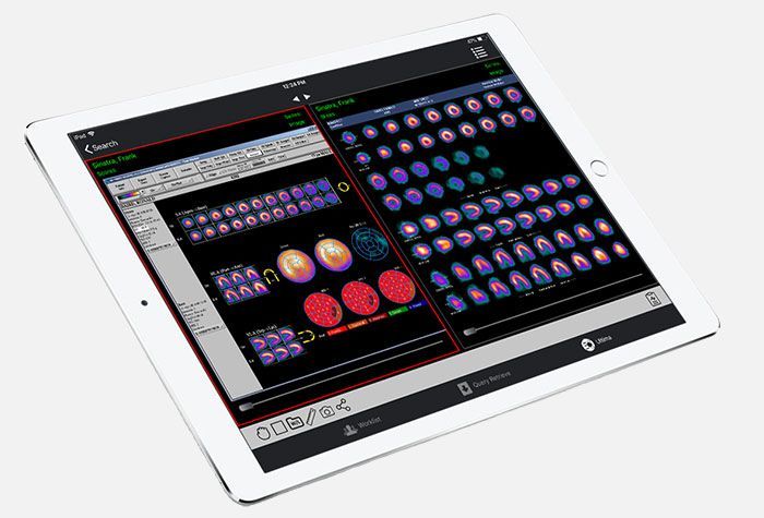 Patient engagement and mobile viewing in healthcare