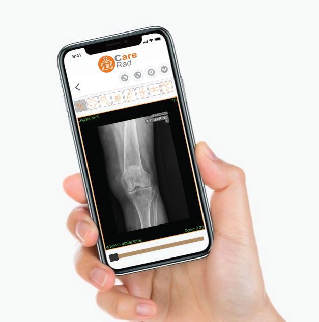 Patient-friendly medical image sharing with CareRad