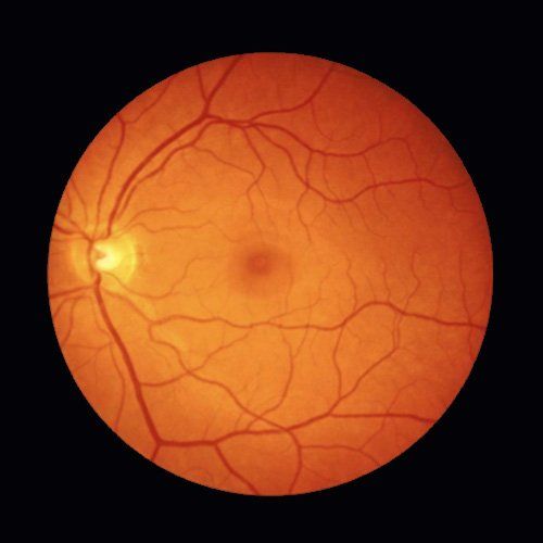 Healthy Retina