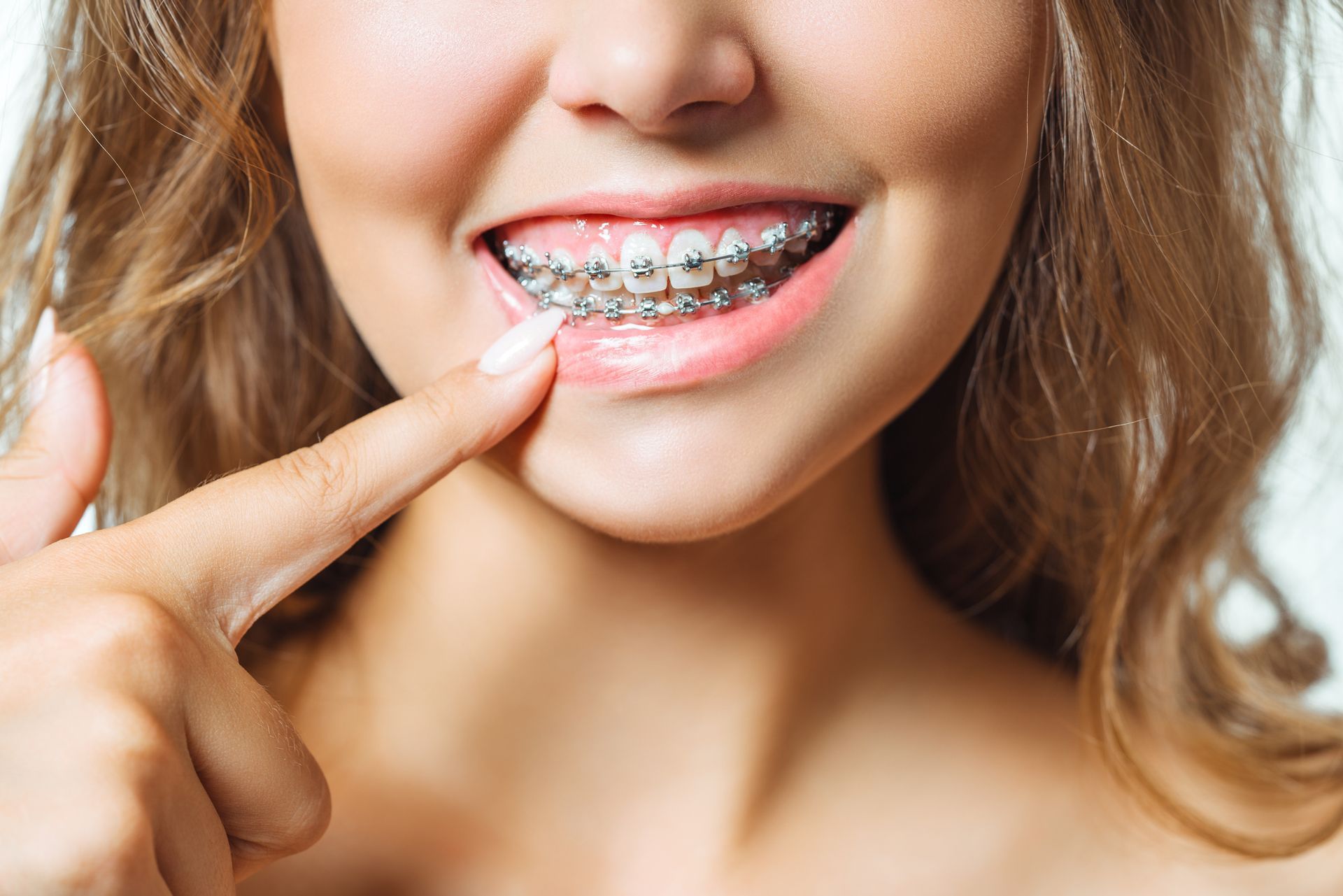 A woman smiling, pointing to her teeth with braces.