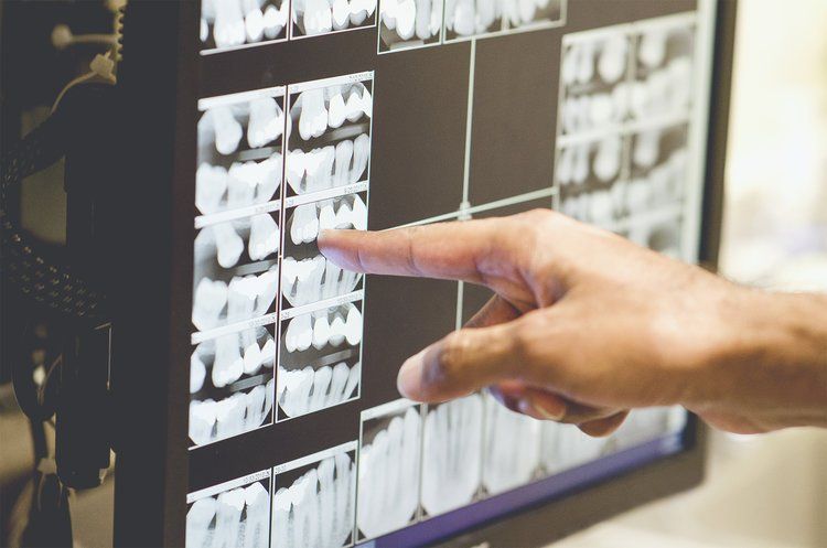 Dentist pointing to xrays | Root canals, veneers, wisdom teeth extractions, dental implants, and more | Monroe Township NJ