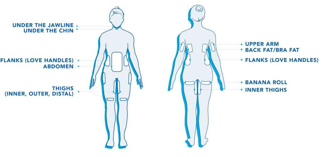 CoolSculpting CoolLuxe CoolSculpting by Marshall