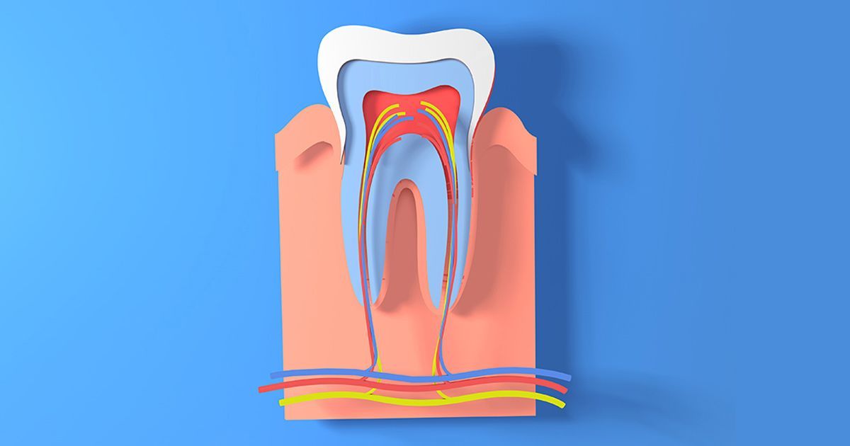 root canal recovery