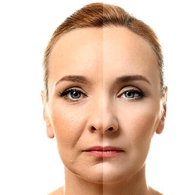 DRA. LORENA CHAPA G - lifting facial