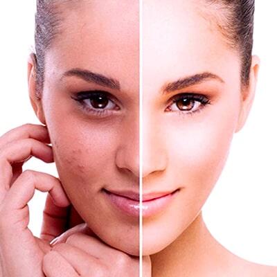 DRA. LORENA CHAPA G - realiza una cita con la dermatóloga