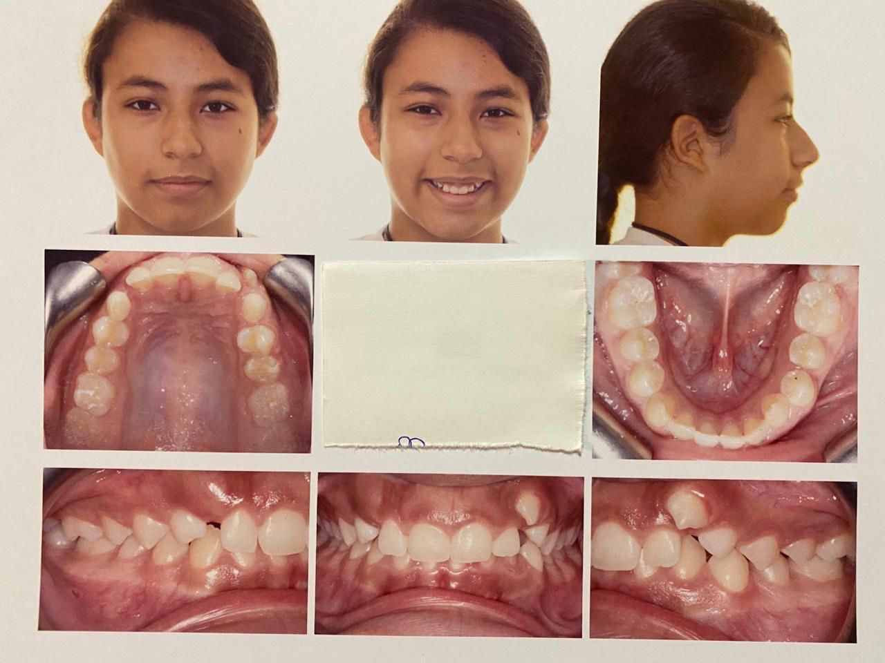 DR. ANTONIO ALCÁZAR FRANCO, DENTISTA ESPECIALISTA EN NIÑOS