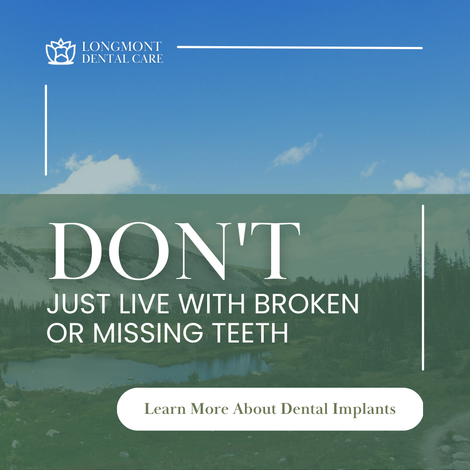 DOs & DON'Ts OF DENTISTRY | Learn About Dental Implants in Longmont CO 80501
