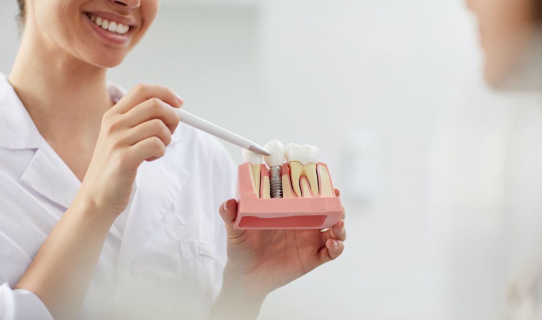 Dental hygienist demonstrating what a dental implant would look like in mouth with an implant model.