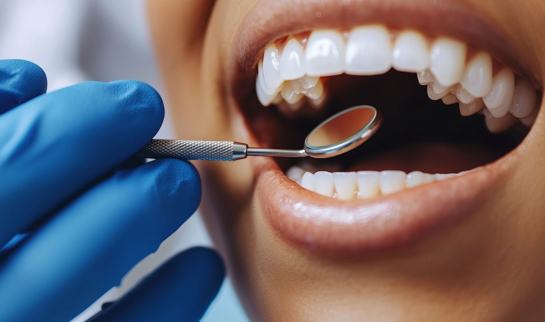 Beautiful smile being examined by dentist. Routine cleaning and preventative dentistry in Salinas, CA.