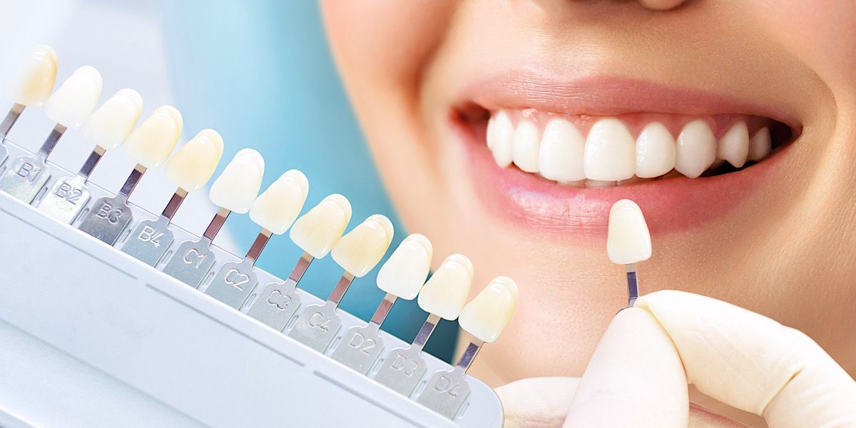 Dentist comparing teeth whitening samples to patient's natural tooth shade while she is smiling.