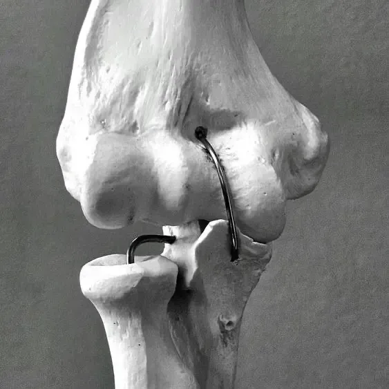 IMPROVE BONE DENSITY