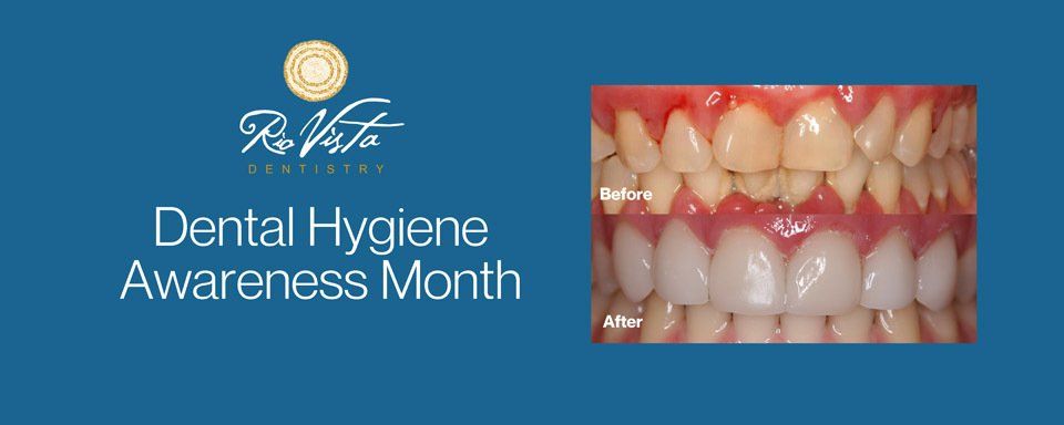 dental hygiene awareness month image