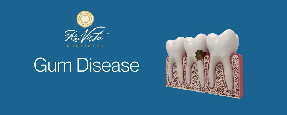 gum disease